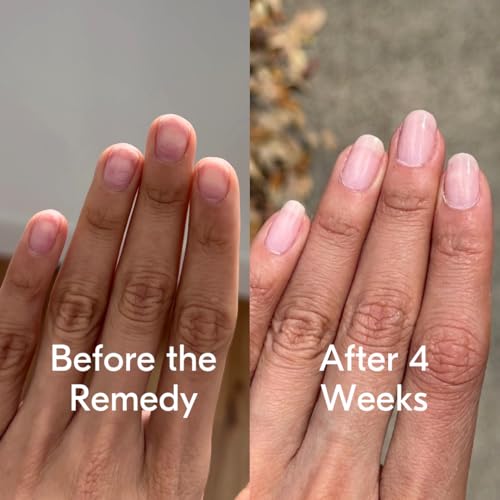 Botanist The Remedy Plant-Based Nail Strengthening Polish - Nude