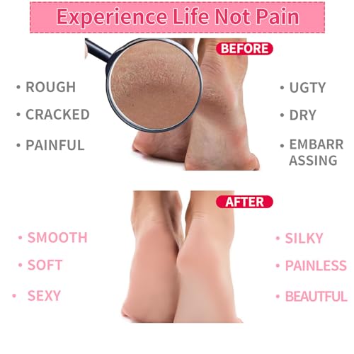 Giloner Moisturizing Gel Socks for Dry Cracked Feet - 2 Pairs Spa Set