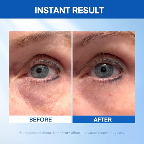 Instant Under Eye Lift Serum - Reduces Bags & Wrinkles