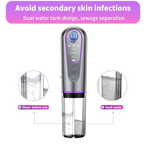 Blackhead Remover Vacuum with 3 Suction Levels & 5 Heads