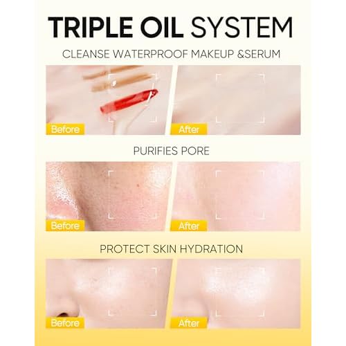 Centella Deep Cleansing Oil, Hydrating Makeup Remover for Waterproof Makeup & Sunscreen, Microemulsion Oil Cleanser with Jojoba & Camellia, 5X Ceramides for Sensitive Skin, Pore Cleansing ? 6.76fl oz