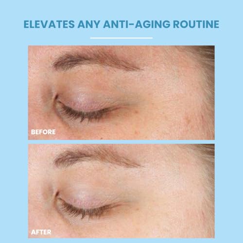 Multi Rejuvenating Vit-Day Protector Sunscreen SPF 40 ? 20% Zinc Oxide, Mineral Face Sunscreen | Invisible, Reef-Safe, Water-Resistant, Hydrating SPF with Hyaluronic Acid | 4.0 oz