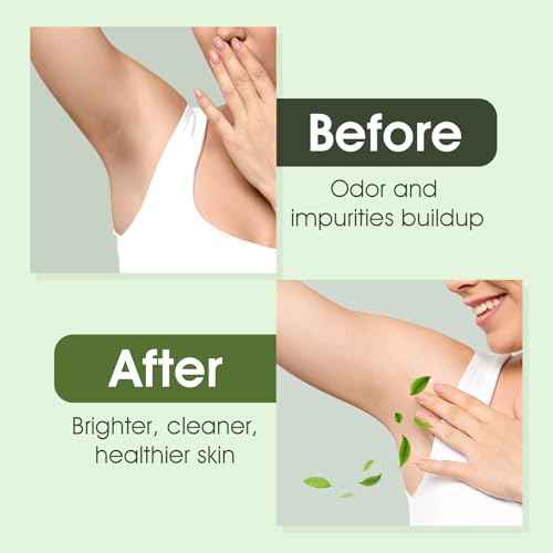 Underarm Detox Soap, 2 Pcs Armpit Detox Soap with Green Tea & Tea Tree, Charcoal & Mint for Eliminating Odor, Exfoliating, Moisturizing , Bar Soap for Legs, Knee, Feet, Hands Whole Body - 10 oz£¨280g£©