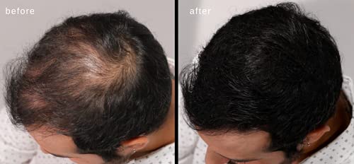 LUXE Hair Building Fibers Dark Brown - Thickening Fibers