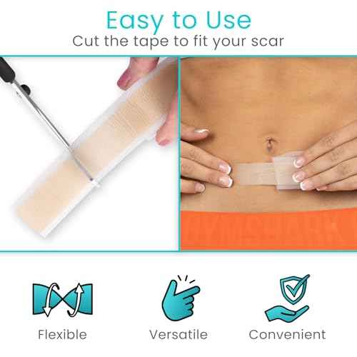 ViveCare Silicone Scar Sheets Tape (1.6" x 120" Roll) ? Medical Grade Silicone Scar Tape for Surgical Scars, C Section, Keloid & Hypertrophic Scars ? Waterproof, Reusable, Adhesive Scar Treatment Roll