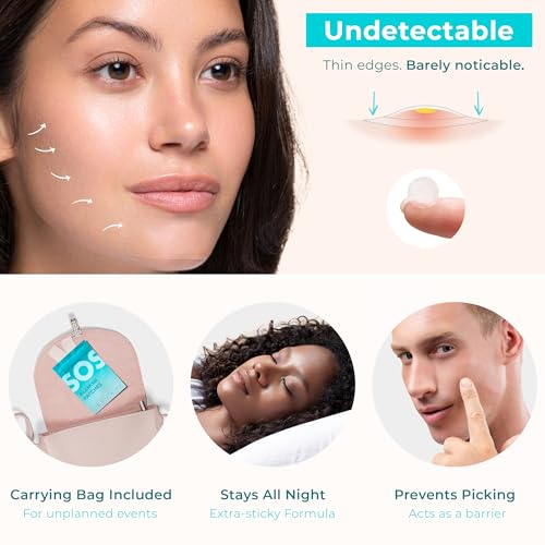 Pimple Patches for Face & Body - Overnight Treatment - Acne Patch for Zits, Dots, Bumps, Spots, Pimples, Whiteheads - Hydrocolloid Stickers -Vegan, Cruelty-Free, Hypoallergenic (XL,8mm,10mm,12mm,14mm)