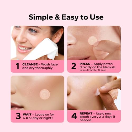 Pimple Patches for Face (18 Count), Microdart Acne Patches, Hydrocolloid Blemish Spot with Salicylic Acid, Fast-Acting for Early Stage Deep Pimples, Zits, Breakouts & Cystic Acne