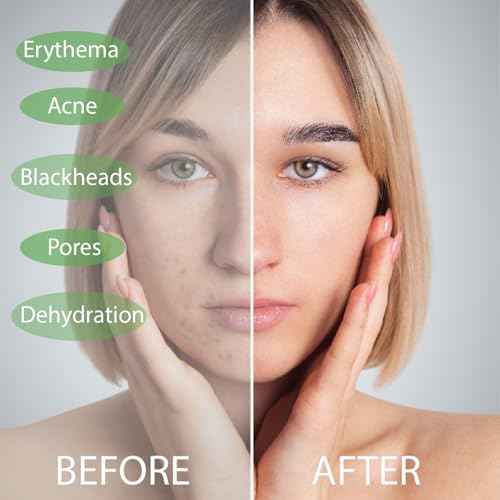 XL Disposable Face Towels 10¡± x 12¡± Eucalyptus Fiber Face Towelettes, Ultra Soft Facial Tissue Wipes for Women, Skin Friendly Dry Wipes Makeup Remover 50 Count (Pack of 1)