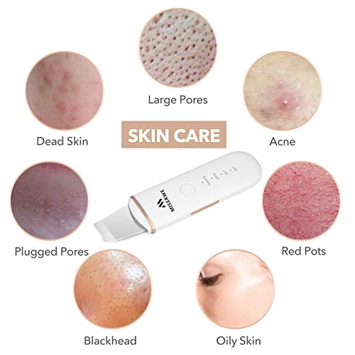 MISERWE Face Skin Scrubber - Deep Cleansing Spatula with 4 Modes