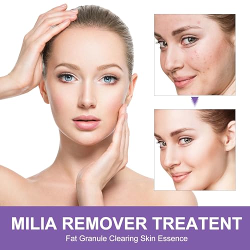 Milia Remover Serum- For Eyes and Face, Milia Remover Treatment for Clear Skin (rose scent))