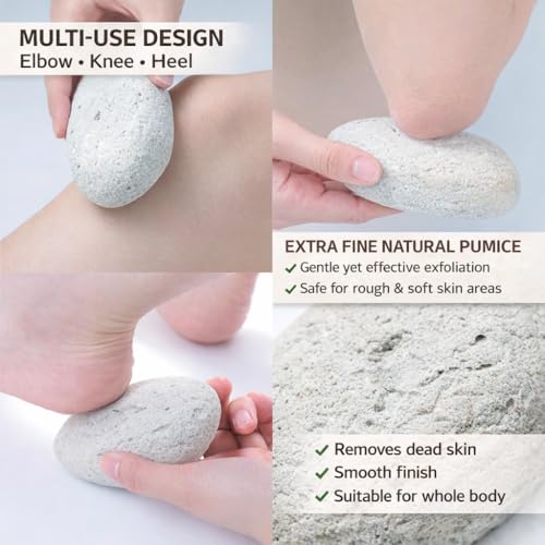 Natural Pumice Stone - Ergonomic Callus Remover for Feet & Elbows