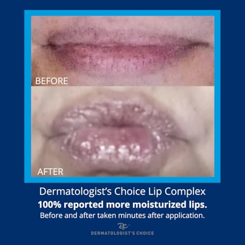 Dermatologist's Choice Lip Complex All-in-One Moisturizing Ointment for Dry, Aging Lips With Castor Oil, Vitamin E, and Evening Primrose Oil to Nourish and Protect Cracked Lips