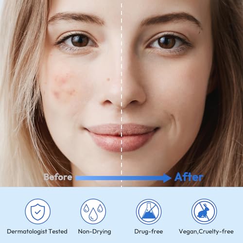 Full Face Pimple Patches(5 Pack),Big Hydrocolloid Acne Patches,Skin Care Zit Patches for Whole Face,Nose, Chin, Forehead & Cheeks w/Tea Tree Oil, Salicylic Acid & Cica Oil£¨5 Pack,25 Patches£©