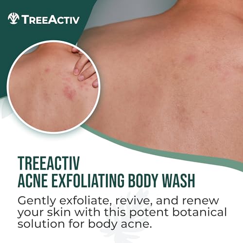 TreeActiv Exfoliating Acne Body Wash 8 fl oz Body Acne Wash for Back, Chest, Shoulder, Back Acne Treatment with Jojoba Beads, Back Acne Body Wash for Bacne, Soothing Body Acne Treatment for Men, Women