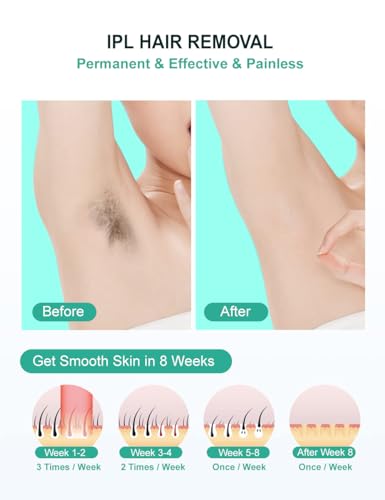 At-Home IPL Laser Hair Removal Device for Full Body, Painless, 999,999 Flashes