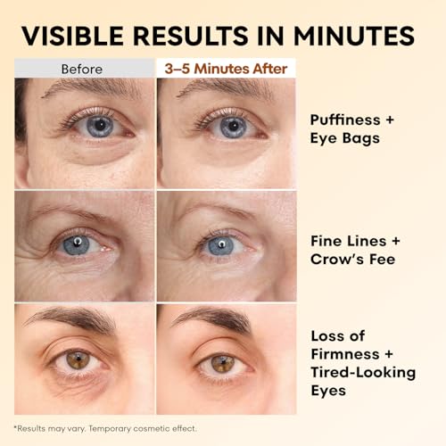 RONKIE Instant Eye Tightener Cream for Bags & Puffiness