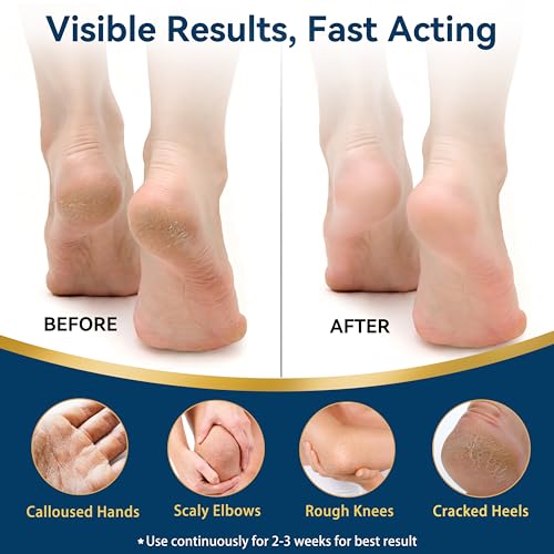 40% Urea Cream with 2% Salicylic Acid - Intensive Repair Foot & Hand Cream