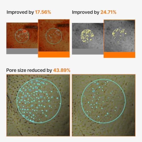 Celimax Pore & Dark Spot Cream Mask Sheet 4-Pack