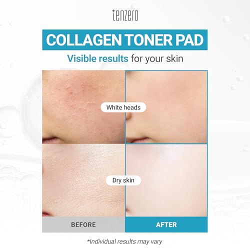 TENZERO Moisture Collagen Toner Pad (70 Count, 160g), 100% Natural Cotton, Hydrating Moisturizing Glowing Face Toner Pads, Gentle Exfoliate & Improve Elasticity, Korean Facial Toner, Dry & Dull Skin