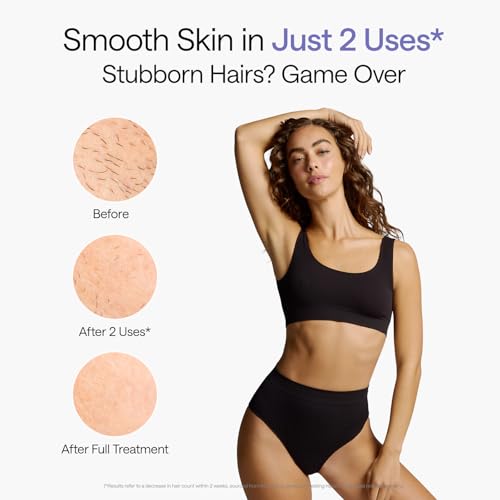 Ulike Air 10 IPL Laser Hair Removal Device - Nearly Painless, Dual Light, 10-Min Full Body Treatment