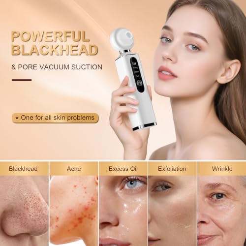 Rechargeable Blackhead Suction Device with LED Light & 5 Tips