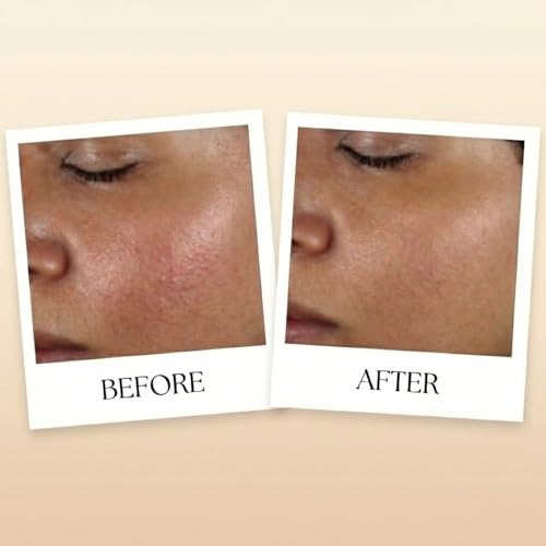 SELENIYA Nourishing Skin Barrier Concentrate Oil, with Ceramide, Peptide, Microalgae, Selenium, 1oz For sensitive, compromised, thin, dry skin and rosacea.