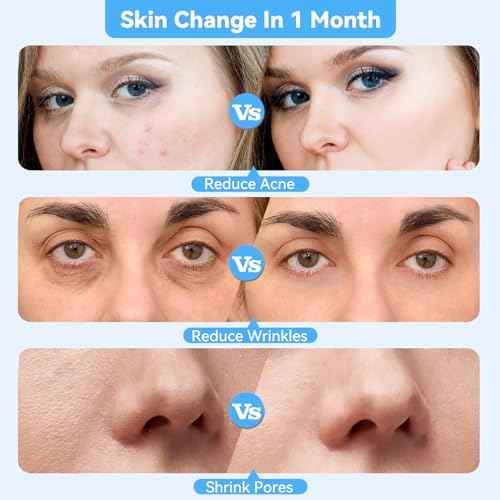 Upgraded Diamond Micro-Dermabrasion Facial Machine, Professional Facial Deep Cleasing Tool, Home Use Facial Skin Care Equipment