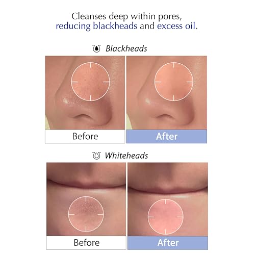 MSM Sulfur Deep Pore Cleanser ? Low pH Barrier-Respecting Face Wash, Pore Reset for Sensitive Skin