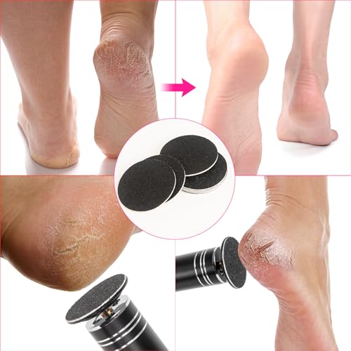 Replaceable Sandpaper Discs for Electric Foot File - 60 Pack (80/100 Grit)
