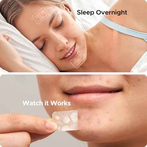 Large Pimple Patches for Face, 7 Sizes Big Acne Patches, XL Hydrocolloid Bandages for Body, Chin, Forehead, Nose, Back Blemish Zit Breakouts, Hydrocolloid Patch (Square, Strip, Dot 306 Count)