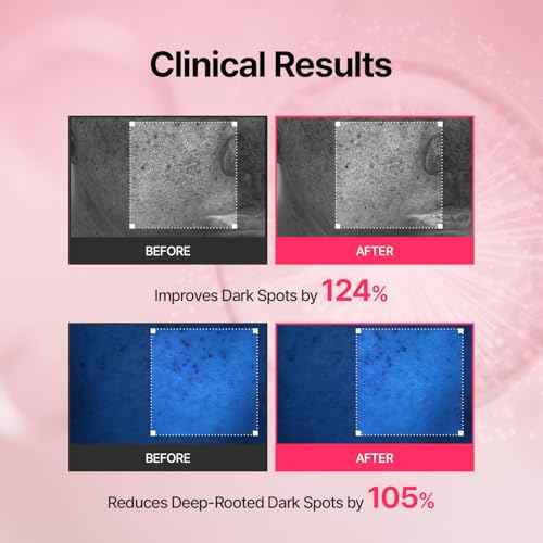 MEDITHERAPY Tranexamic Acid Skin Booster Cream 3.4 Fl Oz - 5% Niacinamide & 3% TXA Korean Face Moisturizer - Gentle Face Cream for Improved Clarity & Even Skin Tone - Radiant Complexion, Natural Color