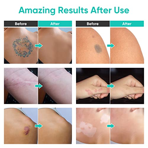 Tattoo Cover Up Makeup Waterproof - Professional Body Concealer