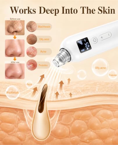 JICICUXI Blackhead Remover Vacuum with Heating & 5 Suction Levels
