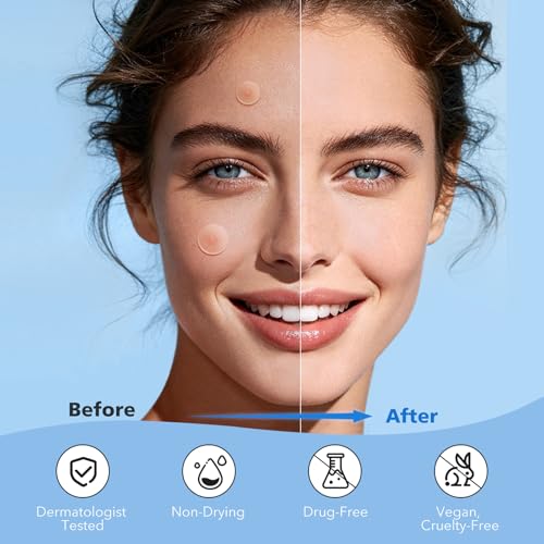 QUSTERE Pimple Patches for Face, Hydrocolloid Acne Spot Cover, 2 Sizes, 288 Count - Clear Zit Stickers with Tea Tree & Salicylic Acid