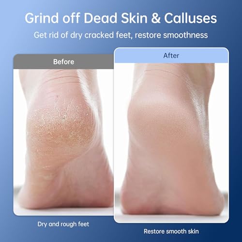 Rechargeable Electric Callus Remover for Feet - Replaceable Sandpaper Professional Foot Grinder 6 Speeds Adjustable Foot Sander, Cordless Electric Foot File Pedicure Tools for Dead Skin, Cracked Heels