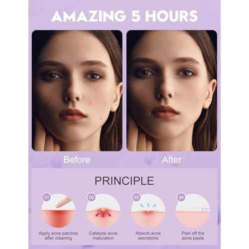 Pimple Patches for Face?Hydrocolloid Acne Patches, 5 Sizes (8/10/12/14/16 mm), 108 ct.?Tea Tree, Salicylic Acid & Centella?Invisible Waterproof Spot Dots, Absorb Fluid & Shrinking Zits and Whiteheads
