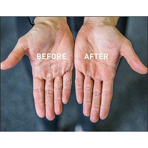 Callus Rx (Formerly BLOQAID) Callus Removal Tool | Eliminates Hard Palm Skin | No Pumice Stone or Gloves | Removes Calluses in Seconds | Best Hand Callus Remover for Workouts, WODs, Weightlifting