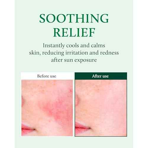 YADAH Cactus Soothing Gel (16.9fl oz) - 95% Cactus Extract, Sunburn Relief, Calm, Cool & Soothe Irritated Skin, Face Redness. Korean Skin Care, Vegan.