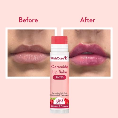 WishCare Tinted Lip Balm with SPF 50 PA+++ ? Enriched with Niacinamide, For Women, 5g