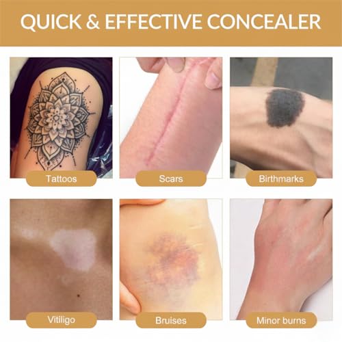 Tattoo Cover Up Patch - Waterproof Concealer Stickers (6 Pcs)