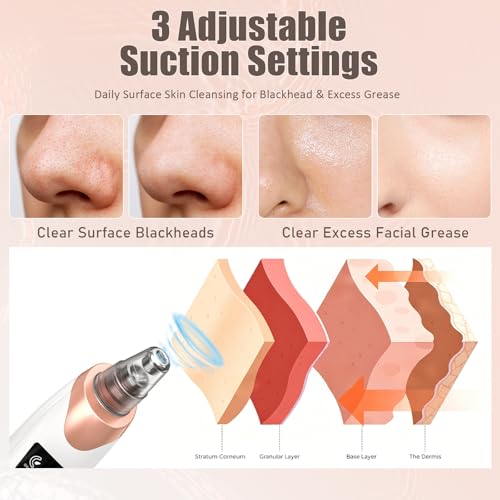 Gackoko Blackhead Remover Pore Vacuum Kit - 5 Suction Levels, USB Rechargeable