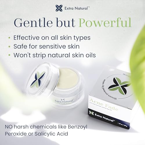 ExtraNatural Acne Cream ? Natural & Gentle Acne Treatment for Sensitive & Oily Skin ? Helps Reduce Breakouts, Pimples & Redness