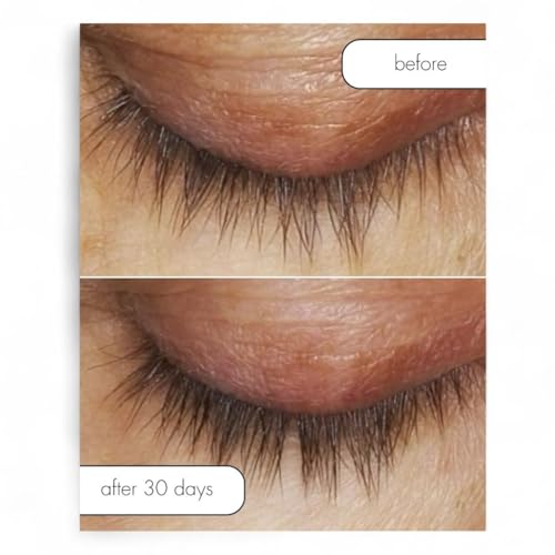 Lash Bath Eye Makeup Remover & Conditioner - 4 oz