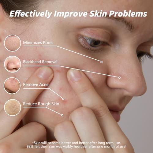 Rosemary Pore Clay Mud Mask - Deep Cleansing Face & Body - 7.05oz