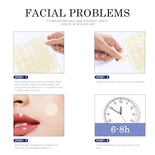 Acne Pimple Patches - 4 Sizes, 220 Count, Hydrocolloid Formula