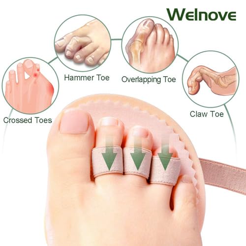 Welnove Hammer Toe Straightener Pads - 2 Pack for Mallet & Claw Toes