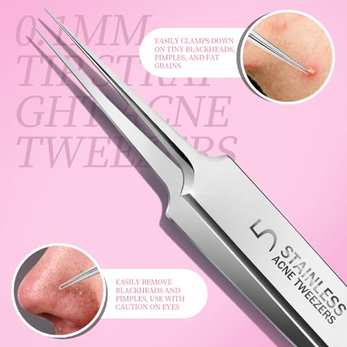 Teenitor Blackhead Remover Tool Kit - 5 Piece Acne Extraction Set