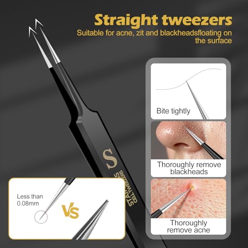 4-in-1 Blackhead Remover Tweezers Set - Stainless Steel