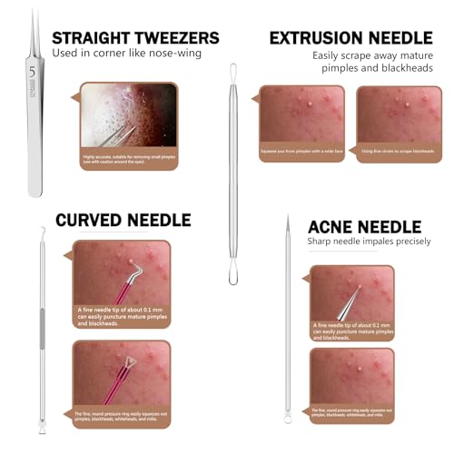 Blackhead Remover Tool Kit 6-Piece Stainless Steel Pimple Extractor