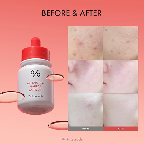 Dr.Ceuracle Azelaic Acid 10 & Madecassoside Ampoule - Redness Relief and Soothing Serum for Sensitive Skin and Blemish-Prone Spot Care, Korean Skincare for Stocking Stuffers